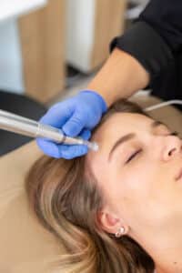 Microneedling at Third Eye Beauty Lounge in Tempe AZ voted top med spa and weight loss clinic