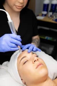 Microneedling at Third Eye Beauty Lounge in Tempe AZ