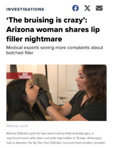 Arizona woman shares lip filler nightmare story by third eye beauty lounge in Tempe AZ "the dangers of going to unlicensed injector"